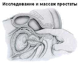 6ab6ab9ae377.jpg